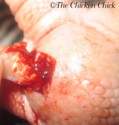 Bumblefoot kernel from chicken's foot pad infection